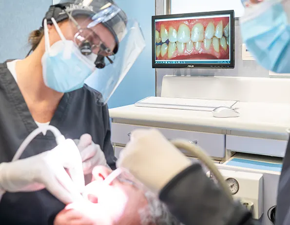 GUNA - Gingivitis ulcerocrotizante aguda