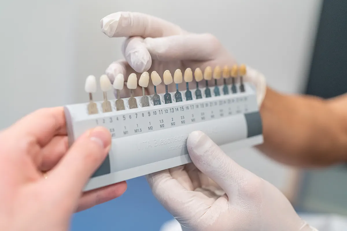 Blanqueamiento dental Estética dental