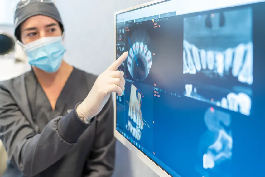CBCT – tecnicas radiográficas CBCT - tecnicas radiográficas