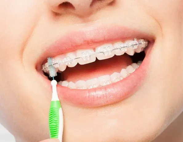 Cepillo interdental