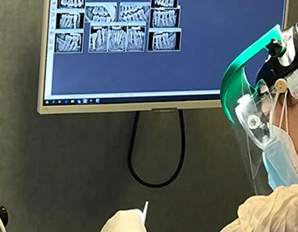 ¿Cuál es la diferencia entre una higiene dental profesional y un mantenimiento periodontal?