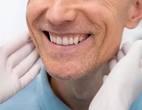 La importancia de la prevención para no sufrir periimplantitis