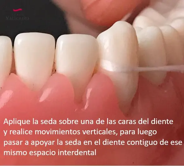 Usar seda dental es fundamental para una buena salud bucodental Usar seda dental es fundamental para una buena salud bucodental