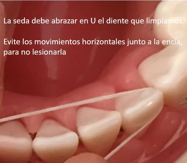 Usar seda dental es fundamental para una buena salud bucodental Usar seda dental es fundamental para una buena salud bucodental