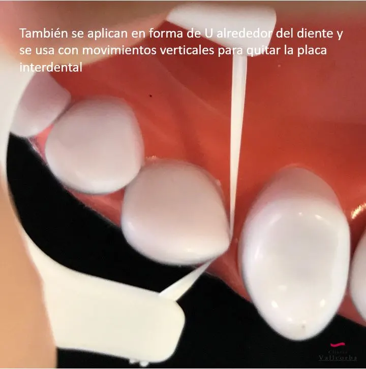 Usar seda dental es fundamental para una buena salud bucodental Usar seda dental es fundamental para una buena salud bucodental