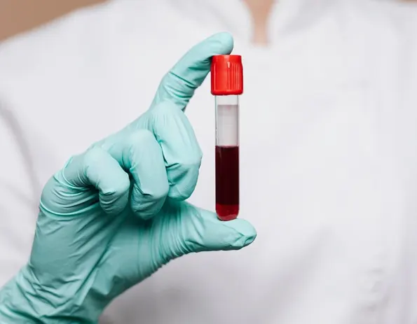Tratamiento anticoagulante: precauciones al ir al dentista