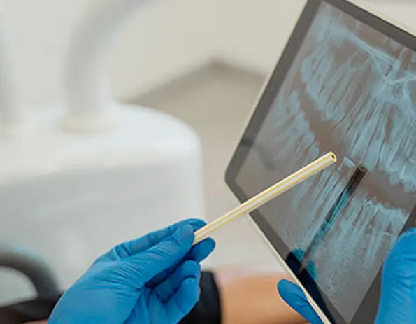 Autotrasplante dental