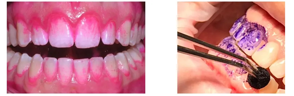 10 consejos sobre higiene bucodental 10 consejos sobre higiene bucodental