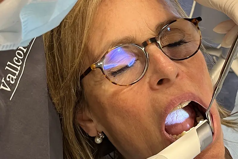 ¿Cuál es el proceso para colocar un implante dental?