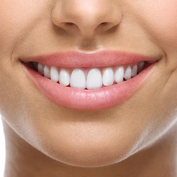 Estética dental Estética dental