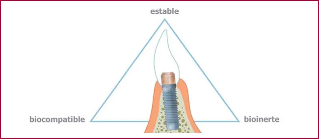 FAQS implantes dentales