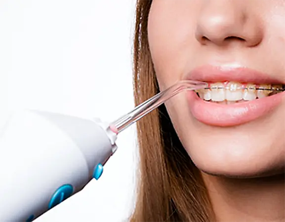 Irrigadores dentales | Clínica Vallcorba