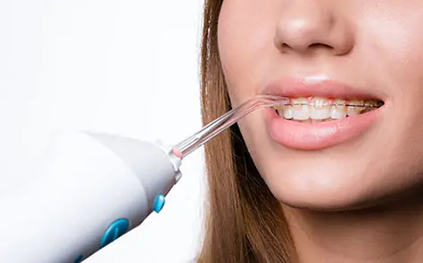 Irrigadores dentales | Clínica Vallcorba