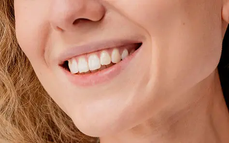 La importancia del control de los implantes dentales – Vallcorba La importancia del control de los implantes dentales - Vallcorba