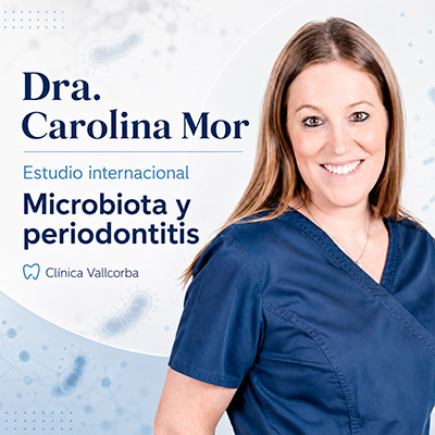 miniatura estudio internacional microbiota y periodontitis - miniatura castellano