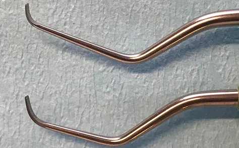 Recomendaciones para tratar pacientes con fenotipo periodontal fino (encía fina)